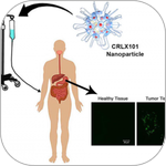 Nanoparticle-Based Cancer Therapies Shown to Work in Humans